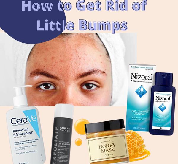 Hyram Approved How to Get Rid of Little Bumps on Your Face