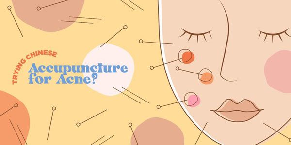 My Unique Solution To Acne And Eczema—Traditional Acupuncture