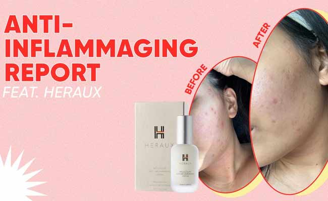 Heraux-This-Anti-Inflammaging-Serum-Can-Teach-Your-Skin-How-to-Heal-Itself