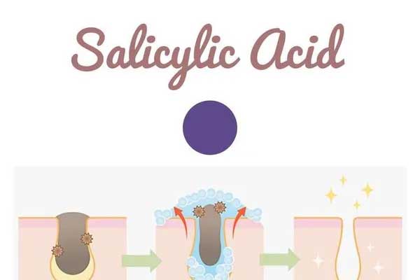 Salicylic Acid Can Save Your Skin, Really