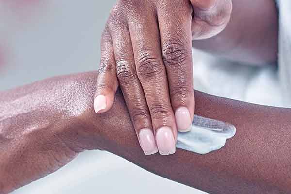The Dos and Don'ts of Skincare for Nummular Eczema