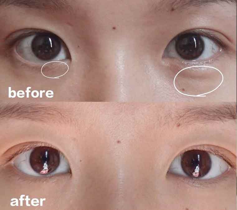 the ordinary caffeine solution before and after